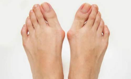 When Should I See a Doctor for Foot Warts? - Podiatry Care Specialists