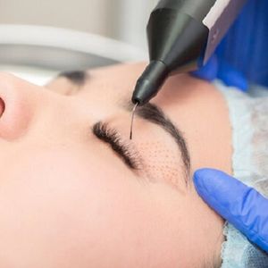 Debunking Common Myths About Eyelid Surgery