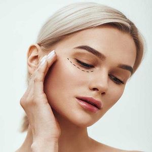 What Is Blepharoplasty? Everything You Need to Know