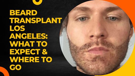Beard Transplant Los Angeles: What to Expect & Where to Go