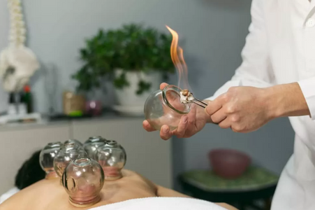 Discover the Healing Power of Dry Cupping Therapy at Dynasty Clinic