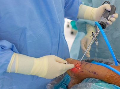 How Arthroscopic Surgery Works: A Comprehensive Guide