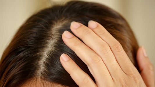 Anti Dandruff Shampoo in Pakistan: Causes, Benefits, and How to Choose the Right One
