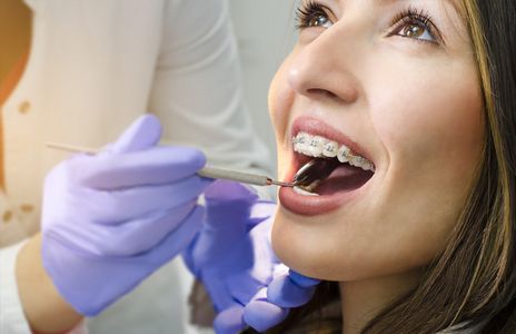 Invisalign Price in India | Compare Clear Aligners & Get Best Deal