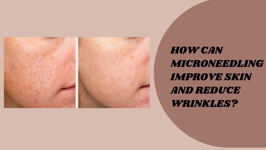 How Can Microneedling Improve Skin and Reduce Wrinkles?