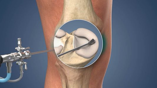 Is Joint Replacement Treatment in Lahore the Right Option for You?