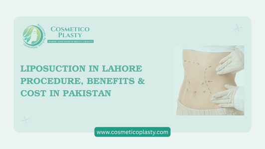 Liposuction in Lahore – Procedure, Benefits & Liposuction Cost in Pakistan