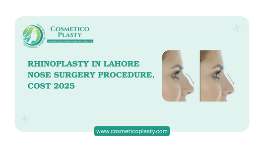 Rhinoplasty in Lahore – Nose Surgery Procedure, Cost & Best Surgeons 2025