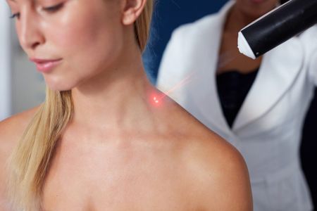 How much does wart removal cost without insurance