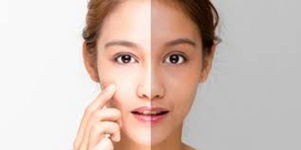 Whitening Injection Guide: Cost, Effects & Long-Term Results