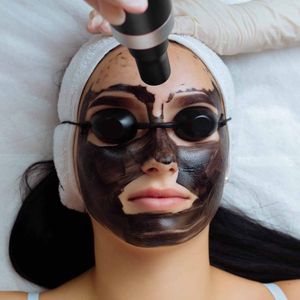 Glow Instantly with Laser Carbon Peel