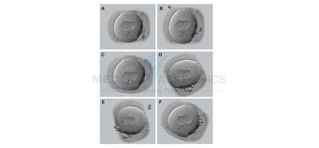 Embryology Courses in Bangalore: Fees, Training, and the Best IVF Hospitals to Learn From