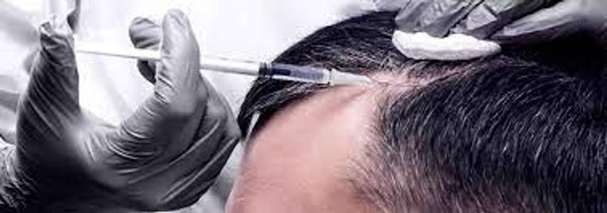 Hair Fillers in the Capital Benefits and Results