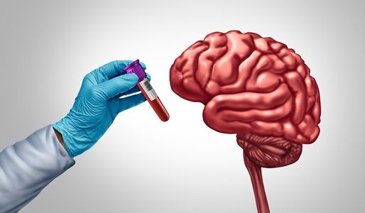 When to Consider Alzheimer’s Screening: Signs and Risk Factors
