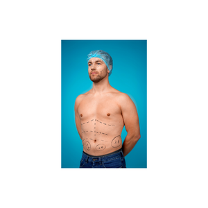 Six Pack Surgery Clinic in Istanbul: Achieve Your Dream Body with Professional Care