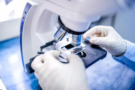 Global Tissue Diagnostics Market 2023-2033: Size, Trends & Key Drivers