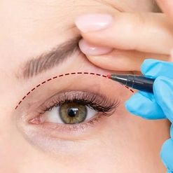 Common Myths About Eyelid Surgery Debunked