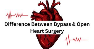 Difference Between Bypass &amp; Open Heart Surgery