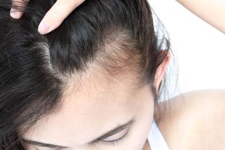 The Science of Biotin and Its Role in Hair Health
