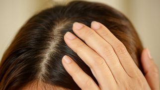 Anti Dandruff Shampoo in Pakistan: Causes, Benefits, and How to Choose the Right One