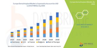 Europe Dental Implant Market Set for Robust Growth Amid Rising Demand for Aesthetic Dentistry