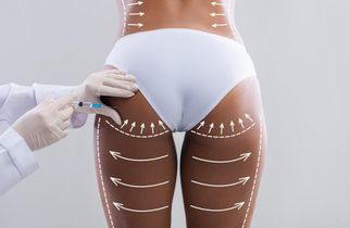 Buttock Augmentation and Body Proportions: Designing a Balanced Look