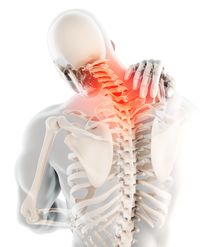 How SCI Affects Bone Health Over Time