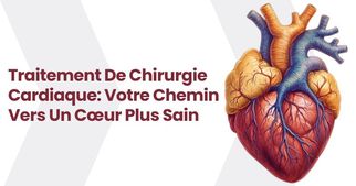 Traitement De Chirurgie Cardiaque: Votre Chemin Vers Un Cœur Plus Sain