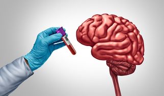 When to Consider Alzheimer’s Screening: Signs and Risk Factors